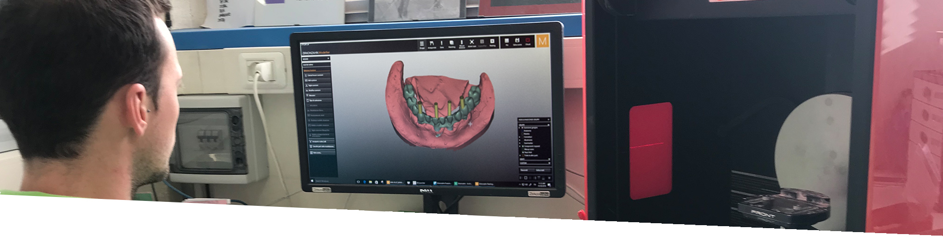 Tecnologia CAD CAM Odontotecnica | Odontocap