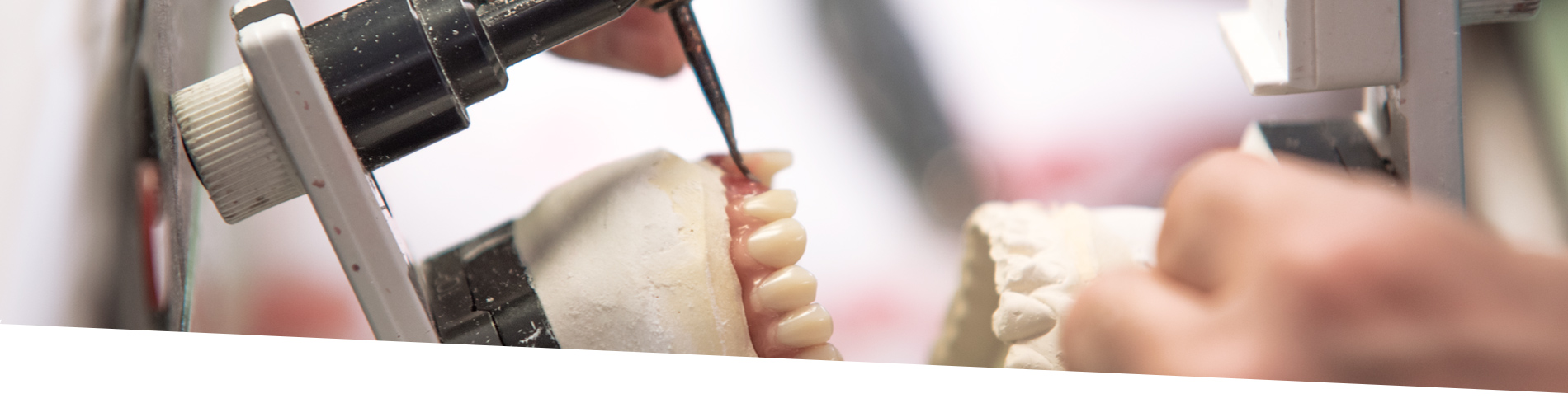 Protesi Dentali in Zirconia Prettau 100% | Odontocap